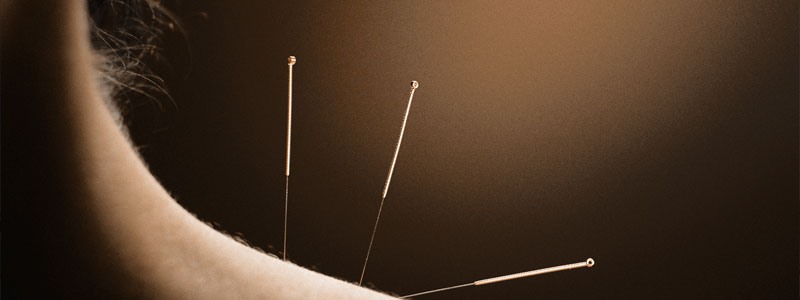 CPD: MEDICAL ACUPUNCTURE & BEYOND